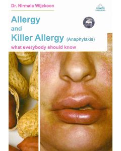 Allergy And Killer Allergy Anaphylaxis